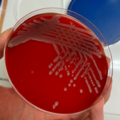 Escherichia coli, krevní agar
