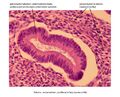 Detail – jednoduchá tubulózní žlázka v endometriu