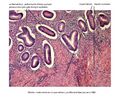 Detail – endometrium a myometrium (proliferační fáze)