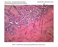 Endometrium a myometrium (proliferační fáze)