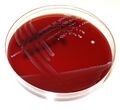 Krevní agar s Enterococcus faecalis