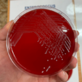 Enterococcus faecalis, krevní agar