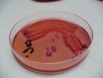 Kultivace Escherichia coli na deoxycholát-citrátovém agaru