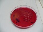 Kultivace Escherichia coli na Endově půdě