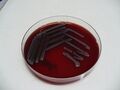 Escherichia coli, krevní agar, detail