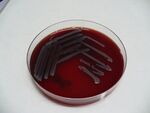 Kultivace Escherichia coli na krevním agaru