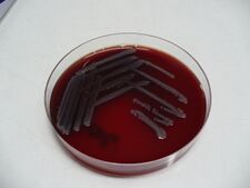 Escherichia coli na krevním agaru