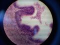 Funiculus spermaticus 2