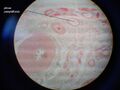 Funiculus spermaticus 3