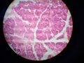 Glandula parotis 1
