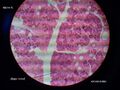 Glandula parotis 2