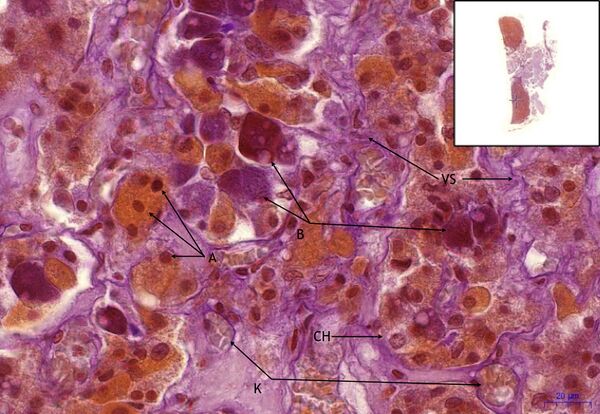 Hypofýza- Hypophysis,PAS+ oranž G, 40x.jpeg