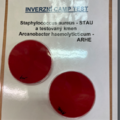 Bakterie používané k reverznímu CAMP testu: Staphylococcus aureus + Arcanobacterium haemolyticum, případně Corynebacterium ulcerans a Corynebacterium pseudotuberculosis