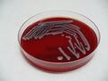 Klebsiella pneumoniae, krevní agar, detail