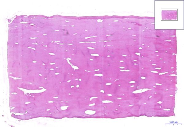 Lamelostní kost-Lamellar bone, HE 0,9x.jpeg