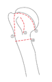 Schéma lomných linií humer (překresleno)