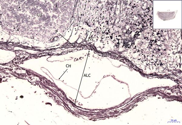 Lymfatická uzlina- lymph node AG 13,4x.jpeg