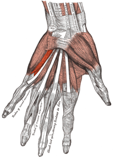 Musculus flexor digiti minimi brevis (ruka)