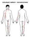 schéma 1 Schematické znázornění obvyklé lokalizace uvolňujících nářezů na těle