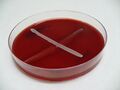 Negativní výsledek CAMP testu. Testovaný kmen Streptococcus pyogenes, inokulační (bílá) čára Staphylococcus aureus.