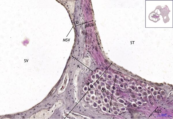 Organum vestibulocochleare HE 16x.jpeg