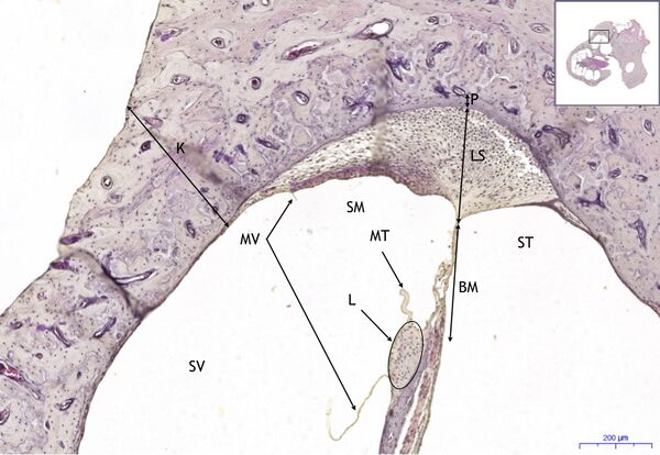 Organum vestibulocochleare HE 5,6x.jpeg