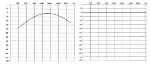 Prahová křivka sluchu (vlevo), relativní sluchový práh (vpravo).png