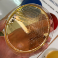 Proteus mirabilis, deoxycholát-citrátový agar