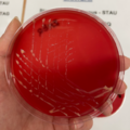 Rhodococcus equi, krevní agar
