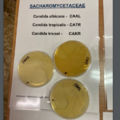 Sacharomycetaceae - kvasinky