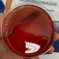 Salmonella enterica, krevní agar