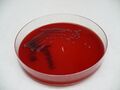 Shigella flexneri, krevní agar, detail