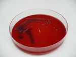 Shigella flexneri – Krevní agar