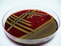 Staphylococcus aureus na krevním agaru