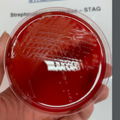 Streptococcus agalactiae, krevní agar