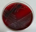 kultivace Streptococcus agalatiae na KA