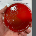 Streptococcus pneumoniae, krevní agar, R-fáze