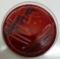 Streptococcus pyogenes na krevním agaru