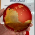 Streptococcus pyogenes, krevní agar
