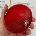 Streptococcus viridans, krevní agar