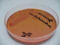 Yersinia enterocolitica, deoxycholát-citrátový agar